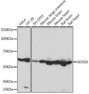 Western blot analysis of extracts of various cell lines, using Anti-SOX10 Antibody [ARC1767] (A309022) at 1:1,000 dilution