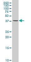 Anti-ACAT2 Mouse Polyclonal Antibody