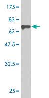 Anti-MAP2K5 Mouse Monoclonal Antibody [clone: M1-E6]