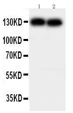 Anti-N Cadherin Rabbit Polyclonal Antibody