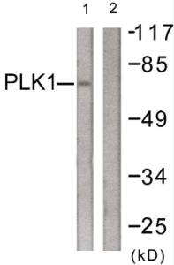 Antibody anti-PLK1 100 µg