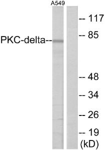 Western blot analysis of lysates from A549 cells, treated with TNF-alpha 20ng/ml 30' using Anti-HSF1 Antibody. The right hand lane represents a negative control, where the antibody is blocked by the immunising peptide