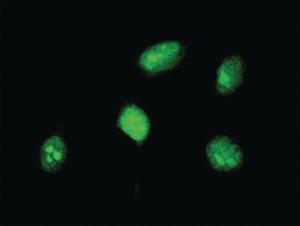 Anti-HOXA5 Mouse Monoclonal Antibody [clone: 4E11]