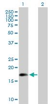 Anti-ARL5A Mouse Polyclonal Antibody