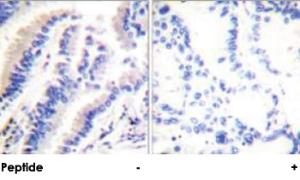 Anti-FADD Rabbit Polyclonal Antibody