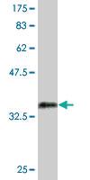 Anti-SP7 Mouse Monoclonal Antibody [clone: 1C11]