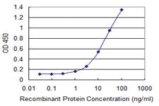 Anti-ZNF268 Mouse Monoclonal Antibody [clone: 3B4]