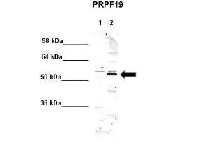 Anti-PRPF19 Rabbit Polyclonal Antibody