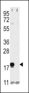 Anti-THY1 Rabbit Polyclonal Antibody (AP (Alkaline Phosphatase))