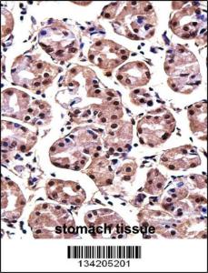 Anti-MAGOH Rabbit Polyclonal Antibody