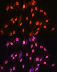 Immunofluorescence analysis of C6 cells using Anti-SOX10 Antibody [ARC1767] (A309022) at a dilution of 1:100 (40X lens). DAPI was used to stain the cell nuclei (blue)