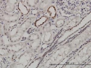 Anti-ARID1B Mouse Monoclonal Antibody [clone: 2D2]