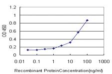 Anti-PSMA7 Mouse Monoclonal Antibody [clone: 1A10-3G12]