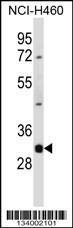 Anti-DNASE1L3 Rabbit Polyclonal Antibody (AP (Alkaline Phosphatase))