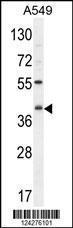 Anti-C5AR1 Rabbit Polyclonal Antibody (APC (Allophycocyanin))