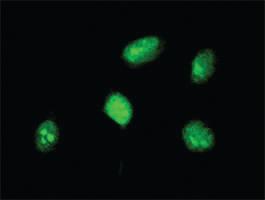 Anti-HOXA5 Mouse Monoclonal Antibody [clone: 4E11]