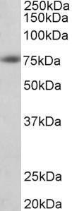 Anti-APP Antibody (A83047) (1 µg/ml) staining of Human Cerebral Cortex lysate (35 µg protein in RIPA buffer) Primary incubation was 1 hour Detected by chemiluminescence