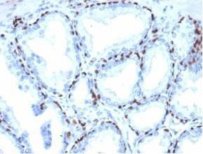 Immunohistochemical analysis of formalin-fixed, paraffin-embedded human prostate tissue using Anti-p40 Antibody [P40/4396R]