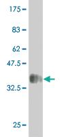 Anti-MAP2K5 Mouse Monoclonal Antibody [clone: 1E5]