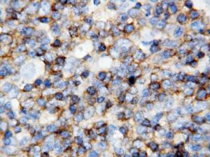 Anti-CD45 Rabbit Polyclonal Antibody