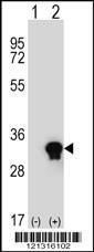 Anti-C1QTNF6 Rabbit Polyclonal Antibody (APC (Allophycocyanin))