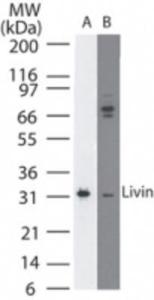 Anti-Livin Mouse Monoclonal Antibody [clone: 88C570]