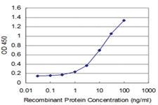 Anti-HOXA5 Mouse Monoclonal Antibody [clone: 4E11]