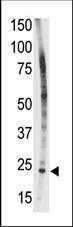 Anti-BID Rabbit Polyclonal Antibody (FITC (Fluorescein Isothiocyanate))