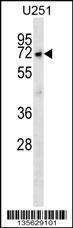 Anti-MKKS Rabbit Polyclonal Antibody (FITC (Fluorescein Isothiocyanate))