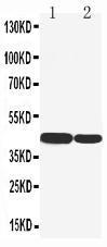 Anti-Cytokeratin 19 Rabbit Polyclonal Antibody