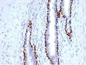 Immunohistochemical analysis of formalin-fixed, paraffin-embedded human prostate tissue using Anti-p40 Antibody [P40/4396R]