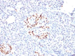 Anti-NKX6.1 Mouse Monoclonal Antibody [clone: NKX61/2561]