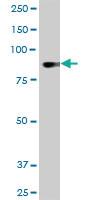 Anti-DYRK1A Mouse Monoclonal Antibody [clone: 7D10]