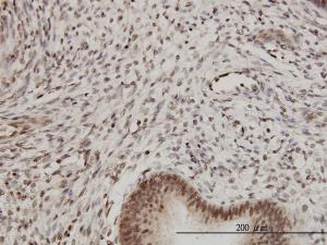 Anti-PSMB2 Mouse Monoclonal Antibody [clone: M1]