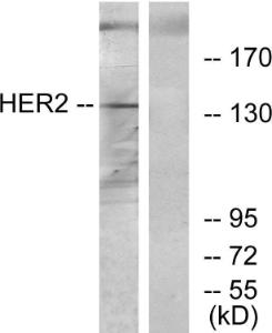 Anti-HER2 antibody