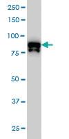 Anti-DYRK1A Mouse Monoclonal Antibody [clone: 7D10]