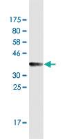 Anti-KIT Mouse Monoclonal Antibody [clone: 4F19]