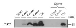 Anti-CD52 antibody