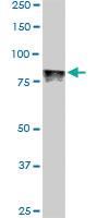 Anti-DYRK1A Mouse Monoclonal Antibody [clone: 7D10]