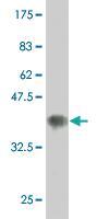 Anti-MAP2K5 Mouse Monoclonal Antibody [clone: 2C2]