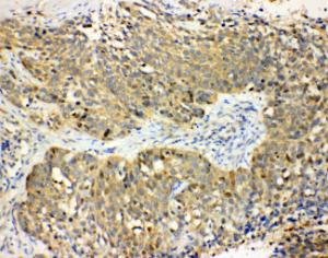 Anti-Haptoglobin Rabbit Polyclonal Antibody