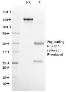 Anti-NKX6.1 Mouse Monoclonal Antibody [clone: NKX61/2561]