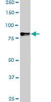 Anti-DYRK1A Mouse Monoclonal Antibody [clone: 7D10]