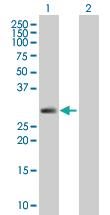 Anti-SPINT2 Mouse Polyclonal Antibody