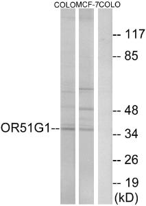 Anti-OR51G1 Rabbit Polyclonal Antibody