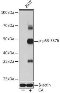 Western blot analysis of extracts of 293T cells, using Anti-p53 (phospho Ser376) Antibody [ARC1531] (A306098) at 1:1,000 dilution