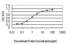 Anti-DYRK1A Mouse Monoclonal Antibody [clone: 7D10]