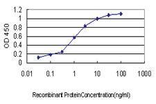 Anti-PSMB2 Mouse Monoclonal Antibody [clone: M1]