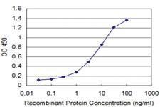 Anti-MREG Mouse Monoclonal Antibody [clone: 1A7]