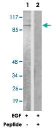 Anti-NR3C1 Rabbit Polyclonal Antibody